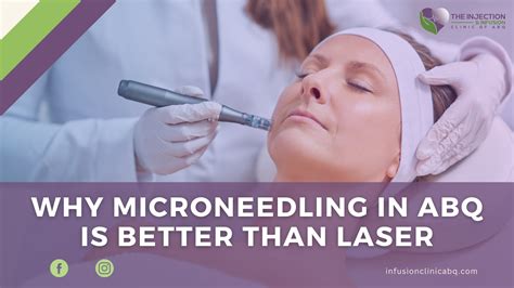 Microneedling vs Laser: Which Should You Go For in ABQ?