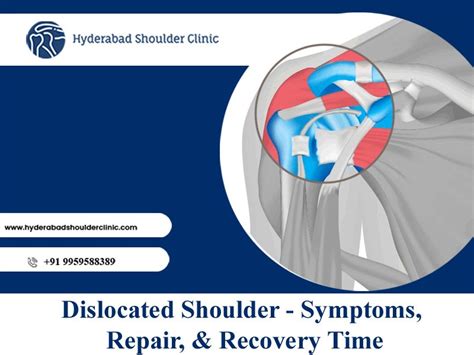 shoulder dislocation emergency management - shoulder clinic Hyderabad