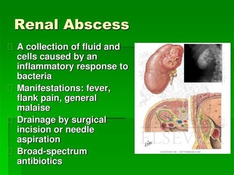 PPT - Interventions for Clients with Renal Disorders PowerPoint ...