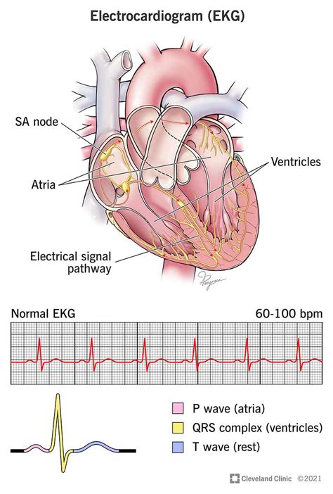 Electrocardiogram (EKG/ECG)