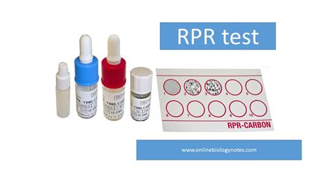 RPR test: Principle, Procedure, Result interpretation and Application