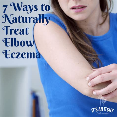 Natural Treatments for Elbow Eczema | itchylittleworld.com