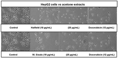 Applied Sciences | Free Full-Text | In Vitro Antiproliferative Activity ...