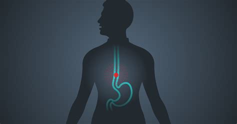 Lower Esophageal Sphincter and Its Anatomy: A Guideline