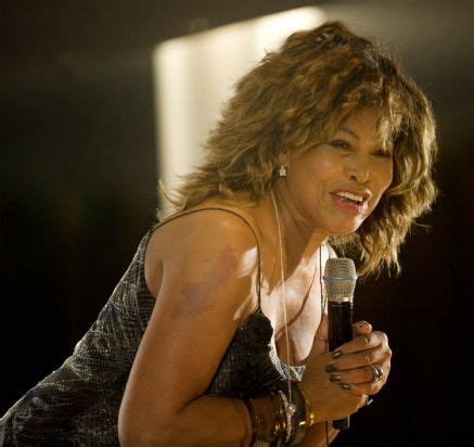 Famous People with Birthmarks | Tina turner, Birthmark, People