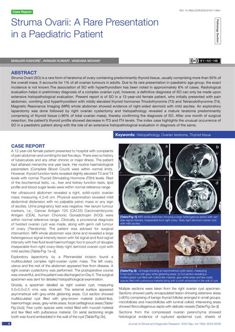 (PDF) "Struma Ovarii: A Rare Presentation in a Paediatric Patient"