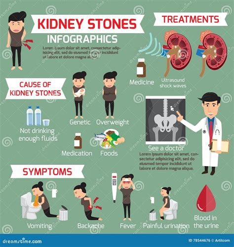 Kidney Stone Infographic. Detail Medical Set Elements Stock Vector - Illustration of health ...