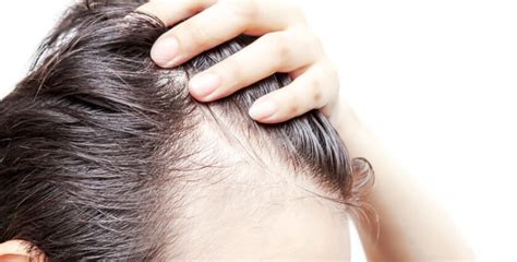 LED Light Hair Loss Therapy - Revive Clinic