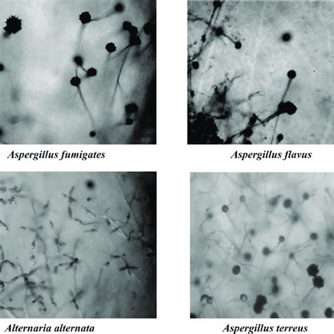 Microscopic observation of selected strains of fungi under 40X high... | Download Scientific Diagram