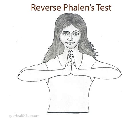 Phalen's Test (Sign): Procedure, Pictures - eHealthStar