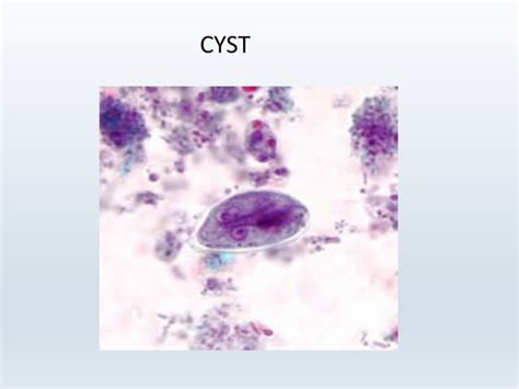 Classification of flagellates and giardia lamblia | PPT