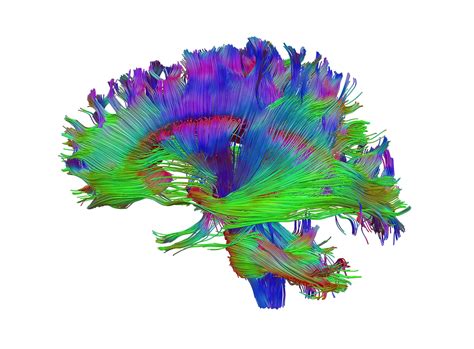 Healthy human adult brain viewed from the side, tractography | Wellcome Collection