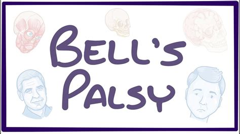 Bell's Palsy Symptoms / Bell S Palsy Causes Symptoms Diagnosis And More - Signs and symptoms of ...