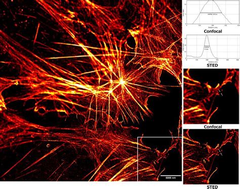 STED microscopy - Alchetron, The Free Social Encyclopedia