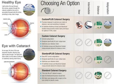 Cataract Lens Options 2024 - Shawn Dolorita