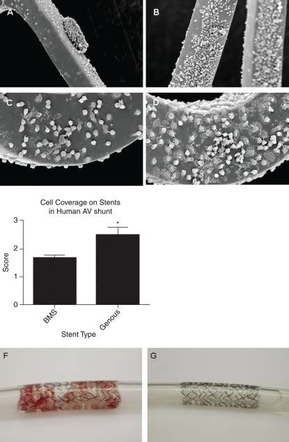 Scanning electron microscopic analysis of the endothelial progenitor... | Download Scientific ...