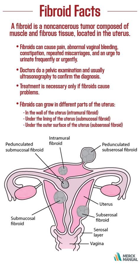 Fibroid Inside Uterus | Uterine fibroids, Health tips for women, Health