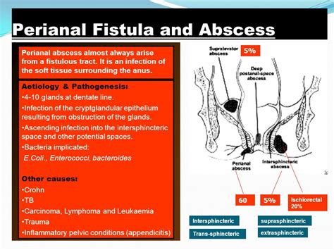 Perianal abscess antibiotics uk