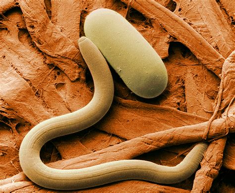 Nematoda - Nematodes - Roundworms - Animalia