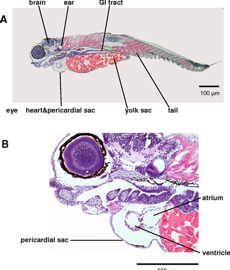 Figure 2 from Investigation of the Morphology of the Heart of Zebrafish Embryos Exposed to ...