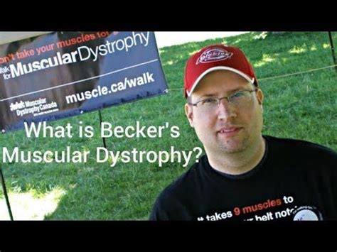 What is Becker's Muscular Dystrophy? - YouTube | Youtube, Muscular dystrophies, Muscular