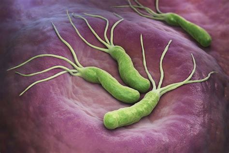 5 Tratamentos naturais para combater a H.pylori a Bactéria causadora de úlcera gástrica – Sua ...