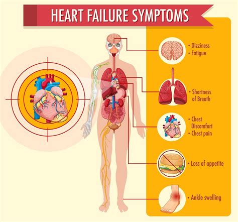 Congestive Heart Failure Cartoon