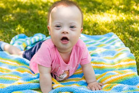 Report: 90% of Babies With Down Syndrome Are Aborted in the UK