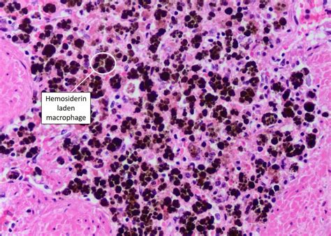 Cell Inclusions – Veterinary Histology