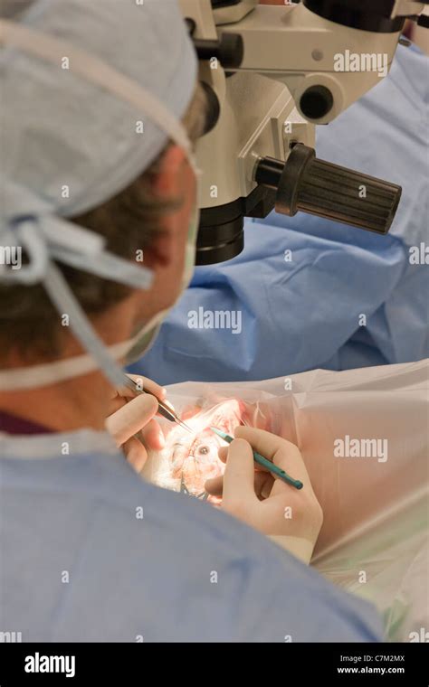 Ophthalmologist performing cataract surgery Stock Photo - Alamy