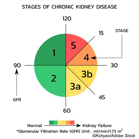 Cystatin-C Holds Key to Unlocking Accuracy and Removing Bias in eGFR Equations - Physician's Weekly