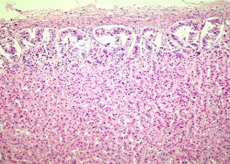 Canine adrenal cortex with zona glomerulosa and zona fasciculata – Collection of Histology Images