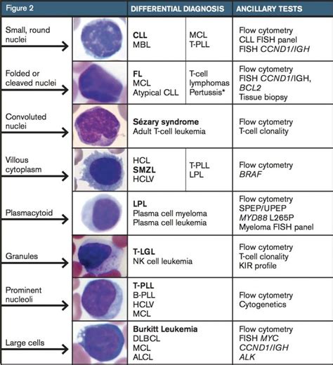 Approach to Lymphocytosis - Ask Hematologist | Understand Hematology