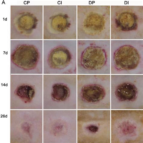 Images and analysis of wound area and reepithelialization. The wound... | Download Scientific ...