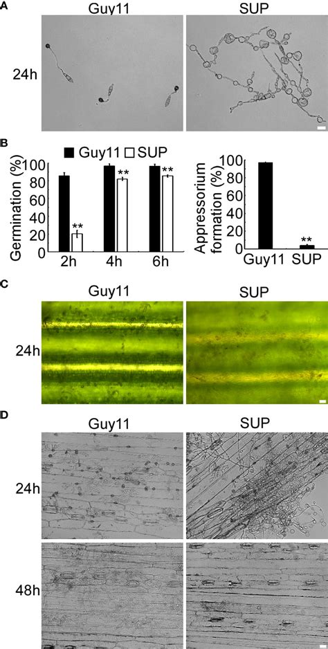 Frontiers | Bacillus subtilis KLBMPGC81 suppresses appressorium-mediated plant infection by ...