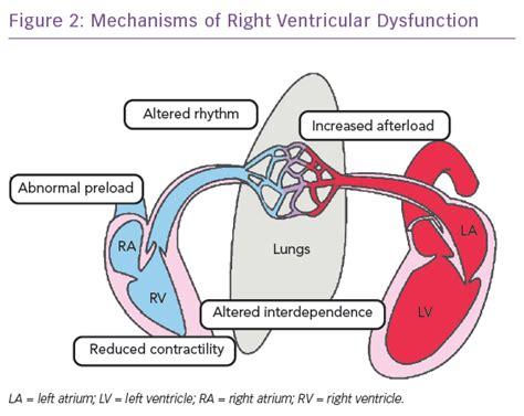 Mechanisms of Right Ventricular Dysfunction | CFR Journal