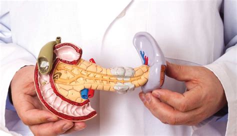 Pancreatic Cancer | MD Anderson Cancer Center