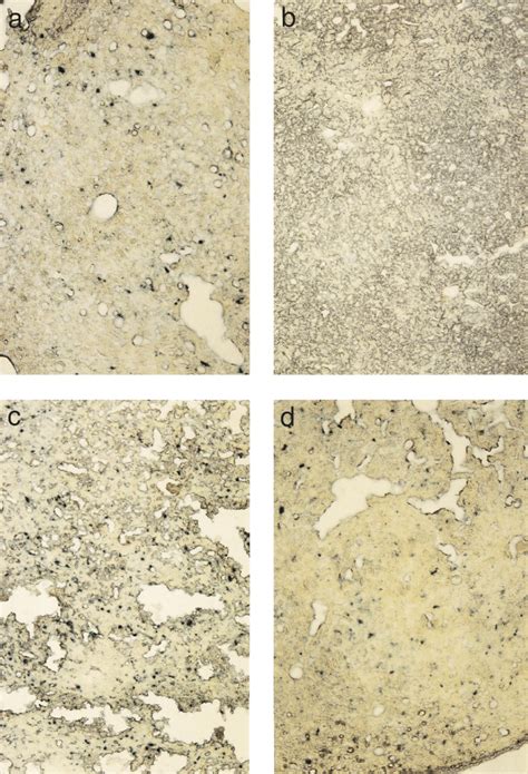 LacZ gene expression in mouse liver on day 7 (a and c) and day 35 (b... | Download Scientific ...