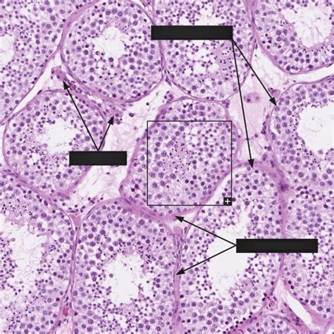 AP 2 Lab - Reproductive System: Male Respiratory System - Histology ...