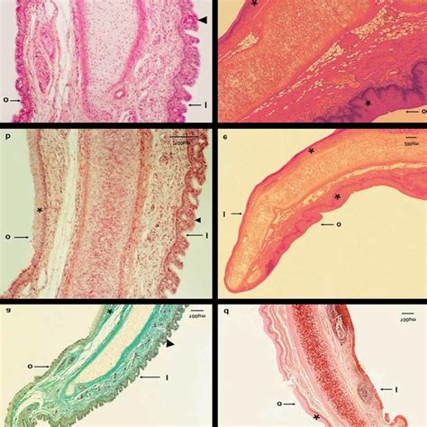 Embryos at Carnegie stages 16 and 17. Note that future epiglottis has... | Download Scientific ...