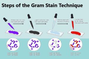 Principle Of Gram Staining 2023 » Flair Pharma The Knowledge Kit.