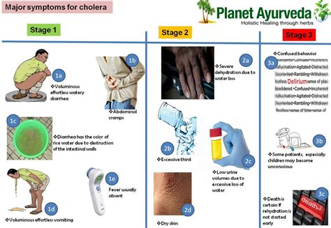 What steps can you take to prevent cholera?-Consultant Portal