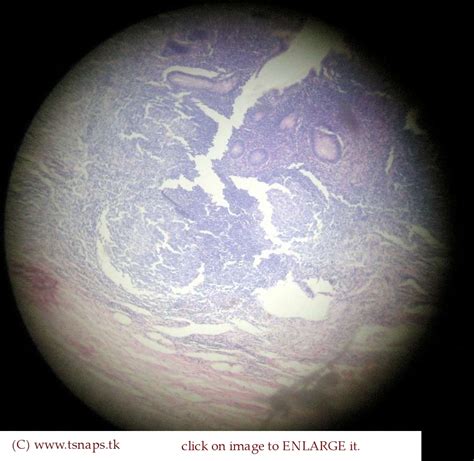 Histology Slides Database: Appendix histology slide (vermiform appendix slide)