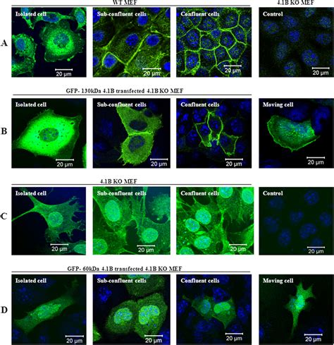 Localization of 4.1B in MEF cells. A, localization of endogenous... | Download Scientific Diagram