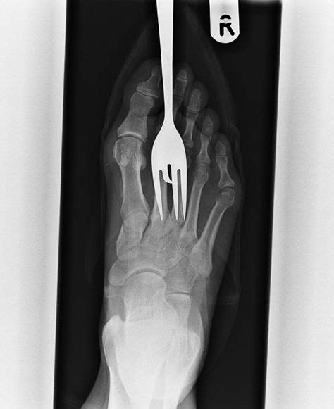 20 Of The World's Most Bizarre X-Rays | Medical pictures, Medical photos, Weird pictures