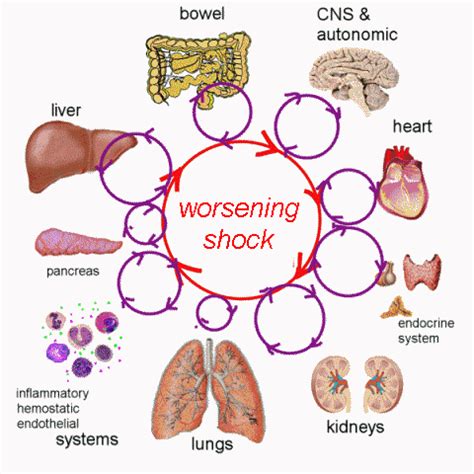 REANIMACIÓN CARDIOHEMODINAMICA DEL … · • Control glucémico • Anabólicos (oxandrolona en los ...