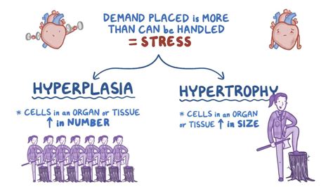 Hyperplasia and hypertrophy: Video & Anatomy | Osmosis