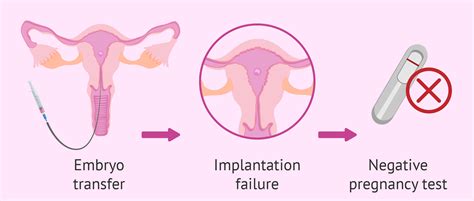 Repeated implantation failures after IVF