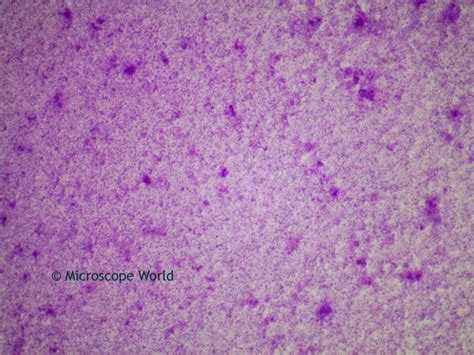 Microscope World Blog: Lactobacillus under the Microscope