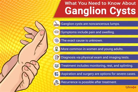 Understanding Ganglion Cysts: Causes, Symptoms, And Treatment - Ask The ...